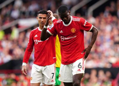 Manchester United's Paul Pogba, right, reacts after a clash of heads during the Premier League match against Norwich at Old Trafford in April 2022. PA