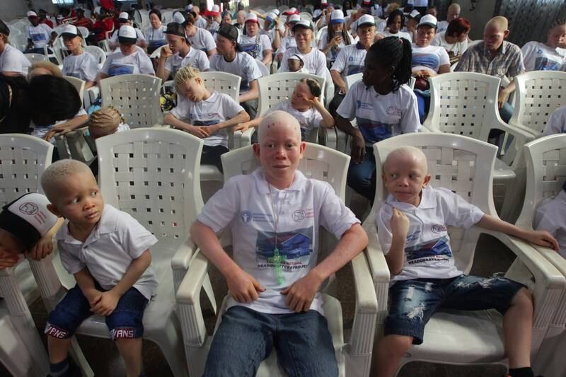 Liberian Albinos mark International Albino Awareness Day in Monrovia, Liberia, June 13, 2022. Albinism is a rare, non-contagious condition in which both parents must carry the gene for it to be passed on. EPA 