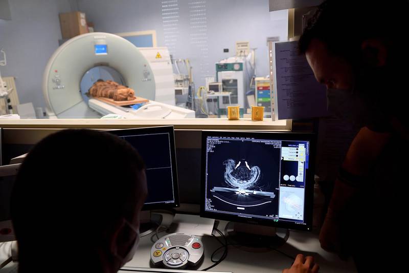 CT has become the gold standard of non-destructive imaging methods in human mummy studies. Photo: Reuters