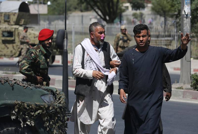 A wounded man is helped after a bomb blast in Kabul, Afghanistan, Monday, July 1, 2019. A powerful bomb blast rocked the Afghan capital early Monday, rattling windows, sending smoke billowing from Kabul's downtown area and wounding dozens of people. (AP Photo/Rahmat Gul)
