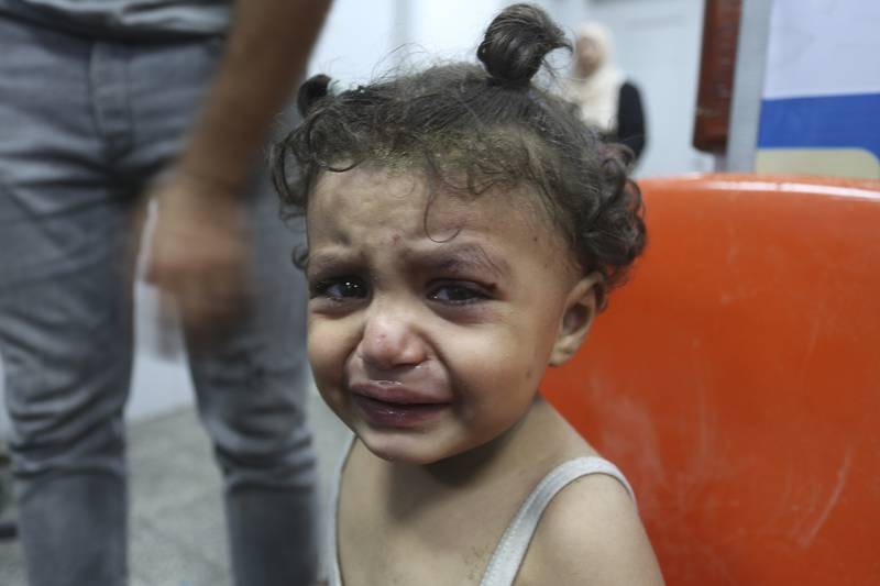 A Palestinian child wounded in an Israeli strike on the Gaza Strip waits for treatment at a hospital in Rafah on Monday. AP