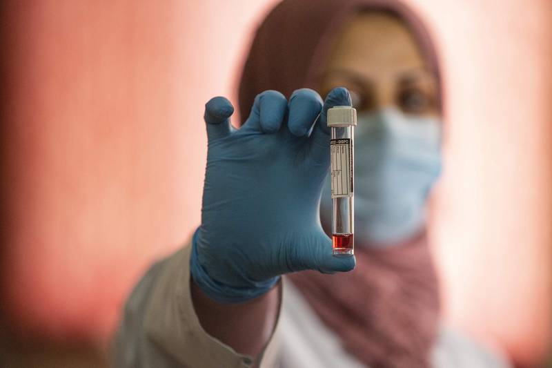 A member of the Covid-19 Crisis Cell holds a vial containing Virus Transport Medium (VTM), a substance that preserves nasal swab specimens while being transported to labs, produced at Basra university in southern Iraq. AFP