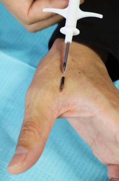 Photo taken on July 23, 2018, shows a microchip and the needle used to inject it into a hand. (Kyodo via AP Images) ==Kyodo