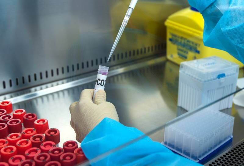 Unilabs, a European diagnostic services firm who is working with health authorities in the UAE has recently developed a new PCR test aimed at identifying the highly contagious Delta variant.