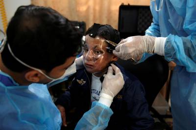 Physiotherapists fit the 3D mask to Ahmed's face at the clinic in Gaza City. Reuters