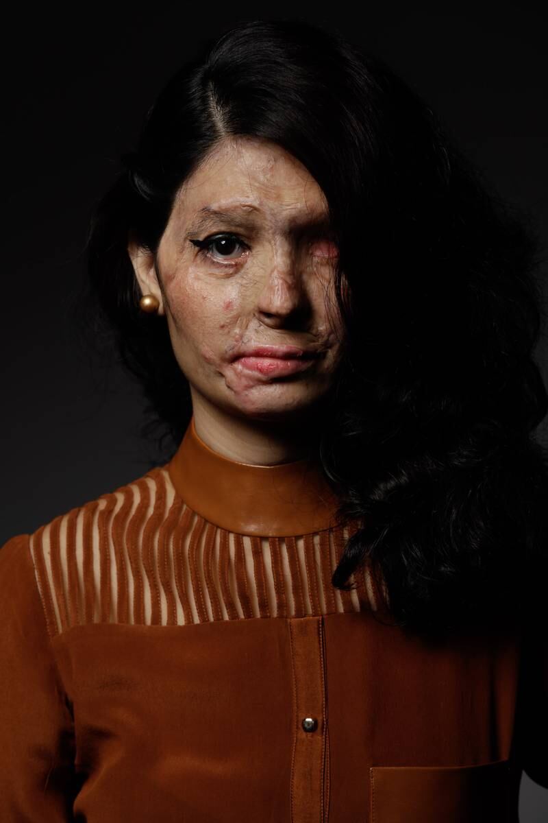 Reshma Qureshi has released a new book titled 'Being Reshma: The Extraordinary Story of an Acid Attack Survivor Who Took the World by Storm.'