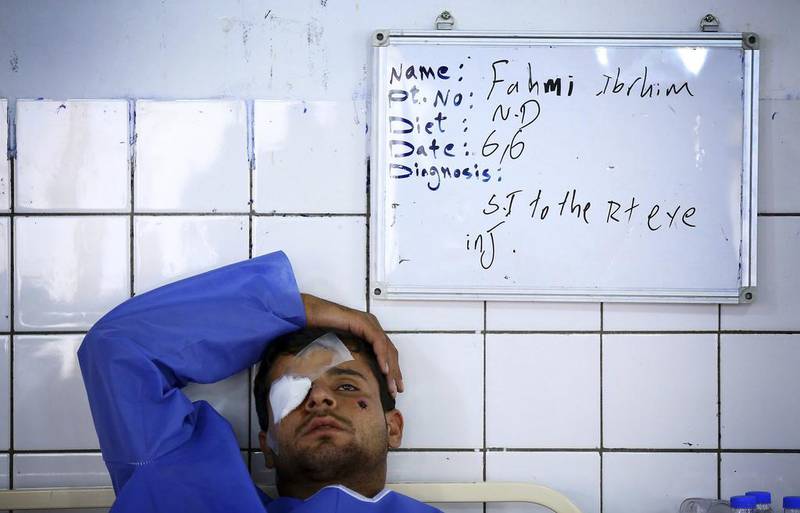 A man, who was injured during a suicide bomber attack in Mwafaqiya village at Mosul, lies in a hospital bed after he was brought for treatment in a hospital in Arbil, the capital of the autonomous Kurdistan region. Reuters