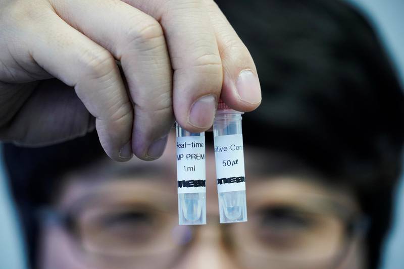 Kim Min-bae, CEO of iONEBIO Inc. poses for photographs with samples of iLAMP Novel-Coronavirus Detection Kit. Reuters