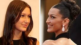 Is 14 too young to get a nose job? Bella Hadid’s surgery and the notion of beauty