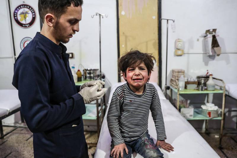 epa06578109 A child injured in shelling reacts during treatment in a hospital in Douma, Eastern Ghouta, Suburb of Damascus, Syria, 03 March 2018. At least ten people were killed in Douma today from shelling allegedly by forces loyal to the Syrian Government.  EPA/MOHAMMED BADRA