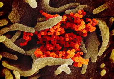 An image provided by The National Institute of Allergy and Infectious Diseases that shows SARS-CoV-2 (orange)—also known as 2019-nCoV, the virus that causes COVID-19—isolated from a patient in the US. The epidemic has disrupted China's economy and dented the travel industry. AP