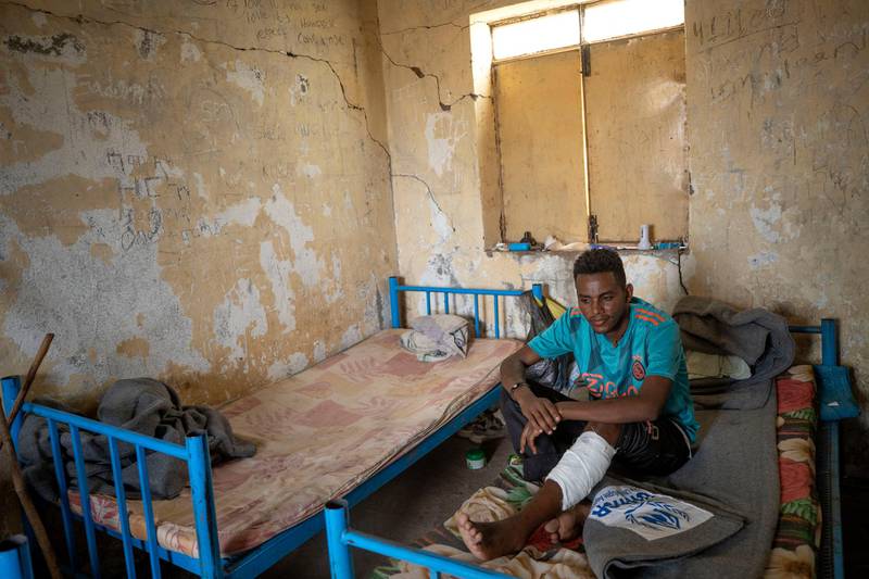 Hiwet Aregawi, 24, a Tigrayan who was allegedly attacked by the 'Fano' militia rests his wounded leg in a shelter at the Hamdeyat Transition Centre near the Sudan-Ethiopia border. AP
