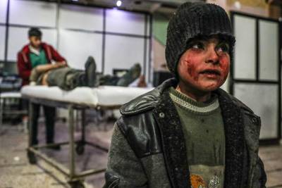 epa06578088 A child injured in shelling seen in a hospital in Douma, Eastern Ghouta, Suburb of Damascus, Syria, 03 March 2018. At least ten people were killed in Douma today from shelling allegedly by forces loyal to the Syrian Government.  EPA/MOHAMMED BADRA
