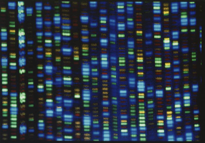 The output from a DNA sequencer. AP