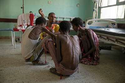 On August 1, 2019, Ethiopian migrants Gamal Hassan, Abdu Yassin, Mohammed Hussein, and Abdu Mohammed, who had been imprisoned and starved by traffickers for months, fed once a day with scraps of bread and a sip of water, pick rice from a bowl at Ras Al Ara Hospital in Lahj, Yemen