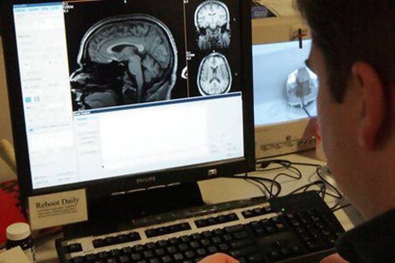 A scientist looks at brain scan images. Photo: AP