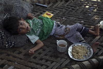 A sick child struggles to eat in Charsadda after his family fled their home due to flooding. AP