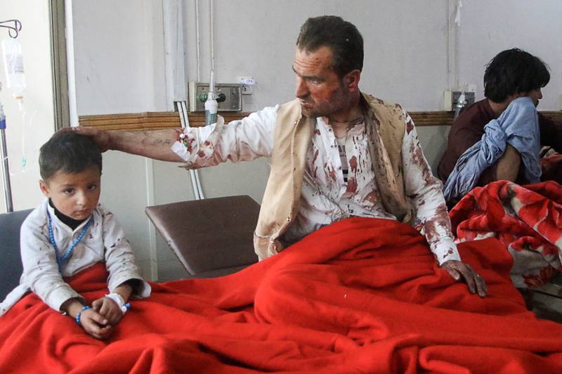 A father and son require aid after being wounded in a suicide bomb. Reuters