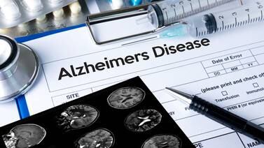 Research suggests activation of astrocytes, along with the build-up of amyloid proteins, is necessary for Alzheimer's disease to progress. JustStock