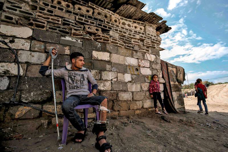 Murad al-Wadyah, a Palestinian youth who was previously injured in a prior demonstration, leans on a crutch as he sits on a chair by his home in Gaza City.  AFP
