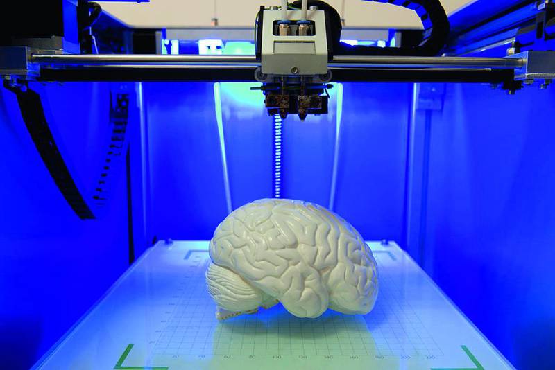 3-D printers have revolutionised health care. Seen here, a printed model of a brain. 