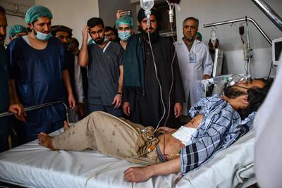 A wounded Afghan man receives hospital treatment after being injured in a bomb blast at a Shiite mosque in Mazar-i-Sharif, Afghanistan. AFP