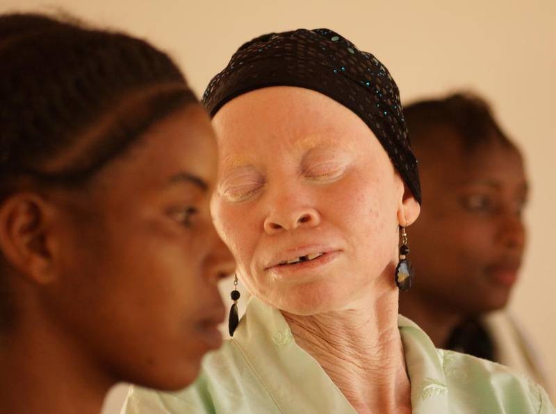 Sabina of Tanzania Albinism Collective. Photo by Marilena Delli  