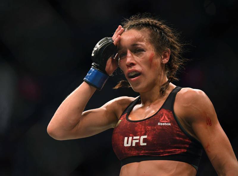 Joanna Jedrzejczyk touches her swollen forehead at the end of a round during a split decision loss to Weili Zhang. AFP