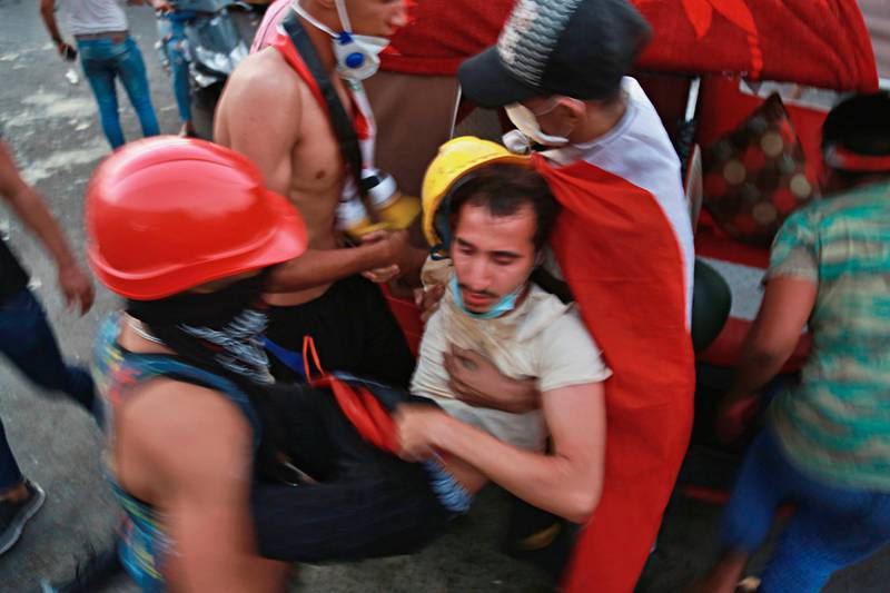 An injured protester is rushed to a hospital in Baghdad. AP Photo
