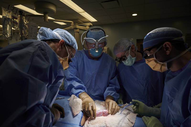 A surgical team at NYU Langone Health in New York City examines a pig kidney attached to the body of a deceased recipient for any signs of rejection. NYU Langone Health via AP