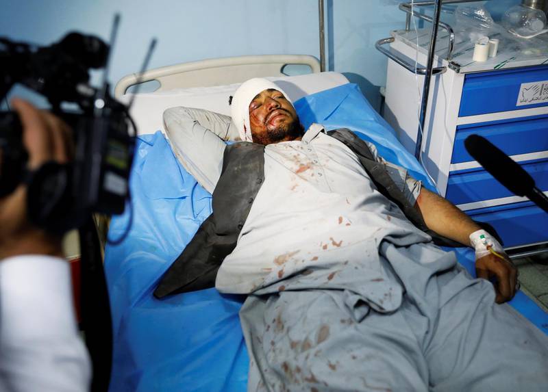 ATTENTION EDITORS - SENSITIVE MATERIAL. THIS IMAGE MAY OFFEND OR DISTURB An injured man recevies treatment at a hospital after a blast in Kabul, Afghanistan, August 7, 2019. REUTERS/Mohammad Ismail