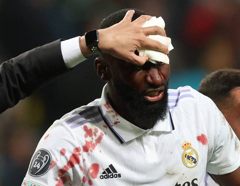 Real Madrid's Antonio Rudiger receives medical attention. Reuters