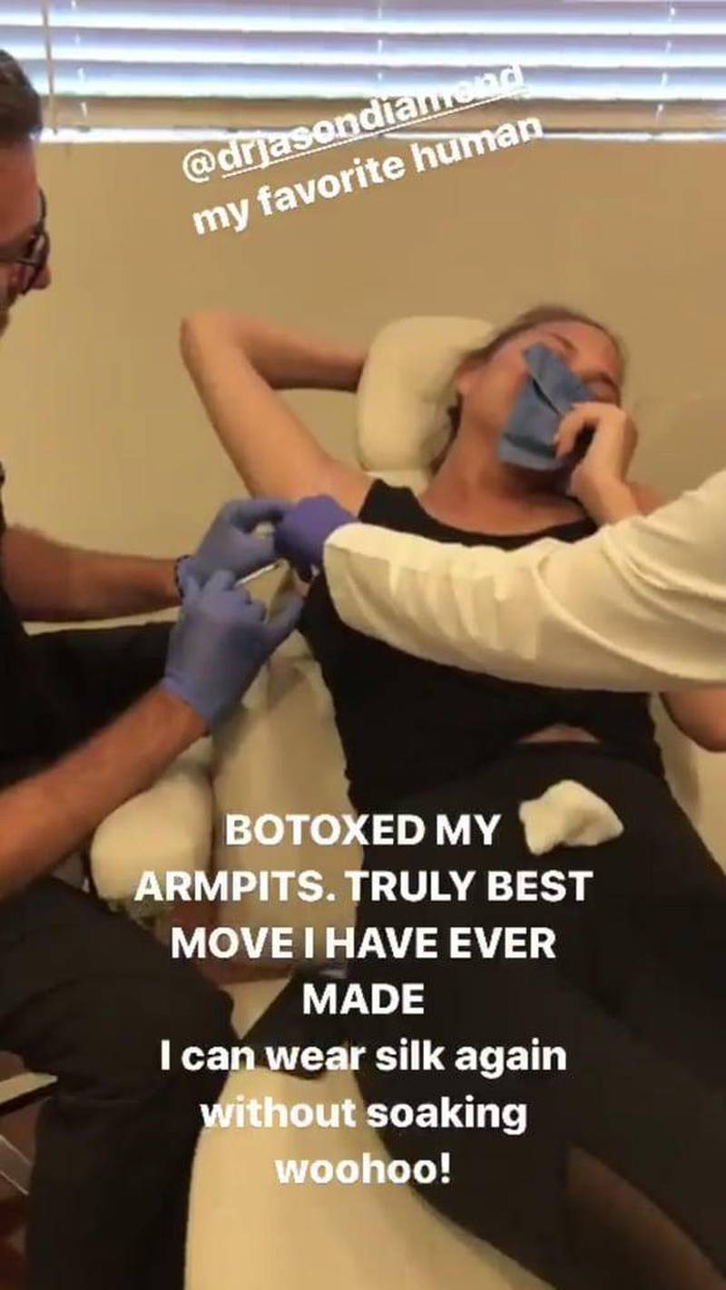 Chrissy Teigen shared a video of her having Botox injections in her armpit. Instagram / Chrissy Teigen