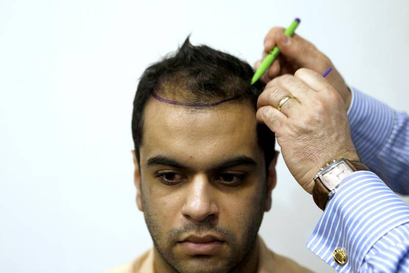 A doctor examines a hair transplant patient at a licensed clinic in Istanbul. Turkey’s cosmetic surgery sector is being undermined by illegal operators. Murad Sezer / Reuters