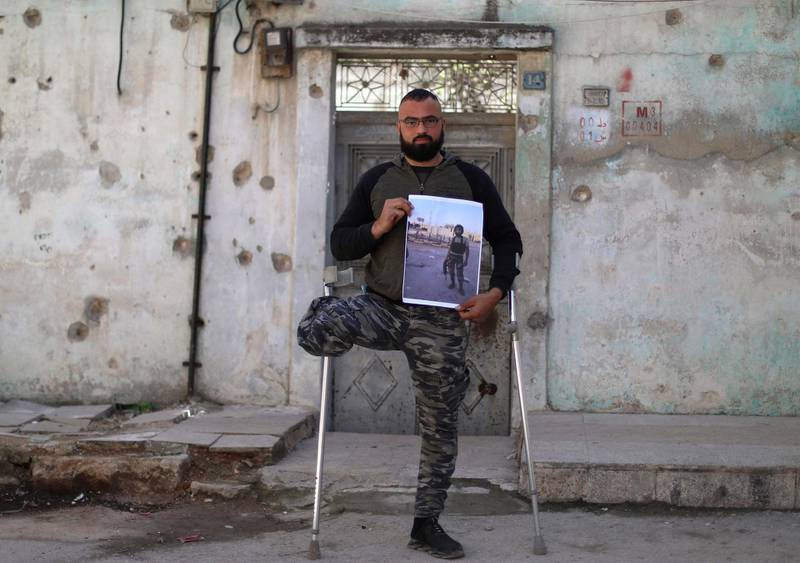 Mohammed Al Hamid, 28, a former Syrian rebel fighter and amputee, poses for a picture while leaning on crutches in the rebel-held northern city of Idlib on March 6, 2021. Hamid says he was wounded in a 2016 battle against government forces in Latakia, where his brother also died in his arms. That same year, he learnt three other siblings had died in prison after they were detained two years earlier. In 2017, war planes bombarded his home in Idlib, killing his daughter. AFP