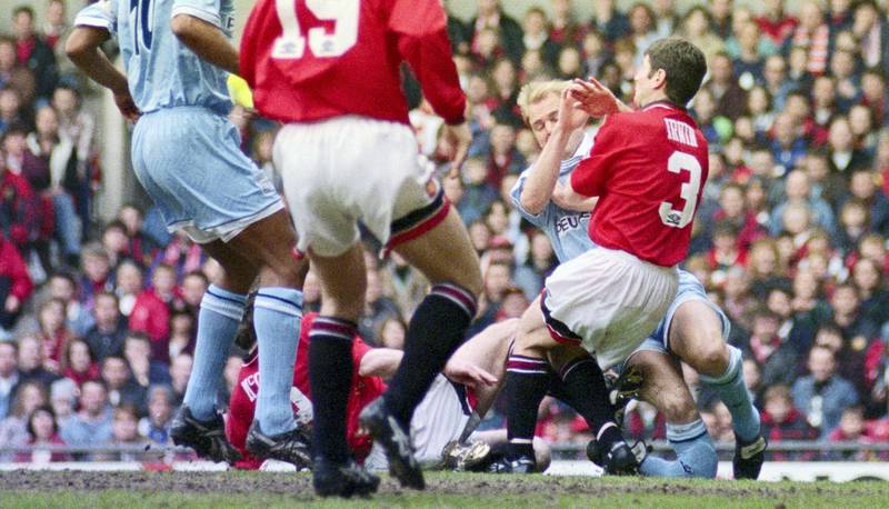 MANCHESTER, UNITED KINGDOM - APRIL 08:  Coventry City defender David Busst breaks his leg resulting in extensive compound fractures to both the tibia and fibula of his right leg after colliding with Manchester United players Brian McClair (obscured floor) and Denis Irwin (r) during the Premier League match between Manchester United and Coventry City at Old Trafford on April 8, 1996 in Manchester, England.  (Photo by Shaun Botterill/Allsport/Getty Images)
