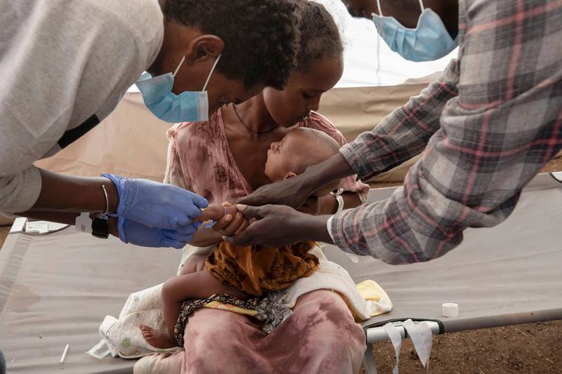 A Tigray woman who fled the conflict in Ethiopia's Tigray region holds her malnourished and severely dehydrated baby as nurses give him IV fluids, at the Medecins Sans Frontieres (MSF) clinic at Umm Rakouba refugee camp in Qadarif. AP