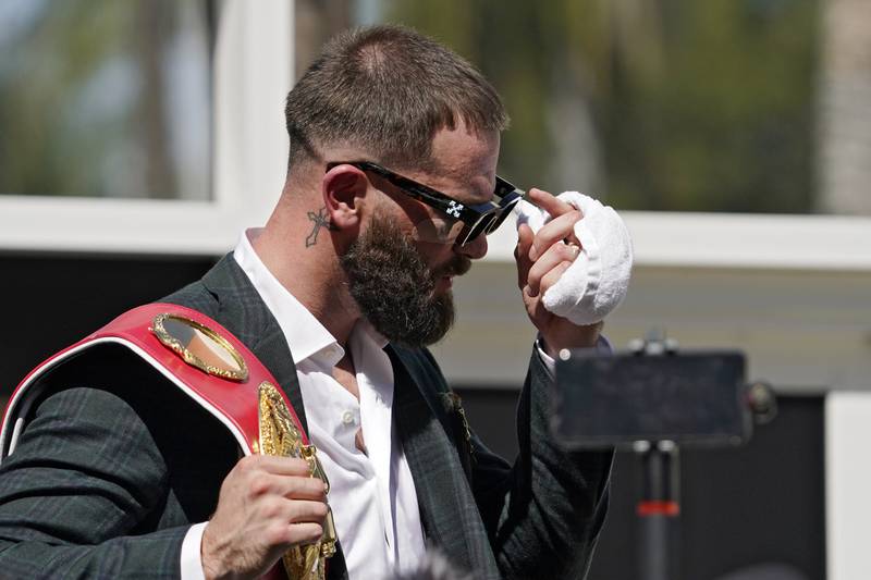 Undefeated IBF Super Middleweight champion Caleb Plant is seen with a cut under his eye after a scuffle with unified WBC/WBO/WBA super middleweight champion Canelo Alvarez during a news conference Tuesday, September  21, 2021, in Beverly Hills, California. AP