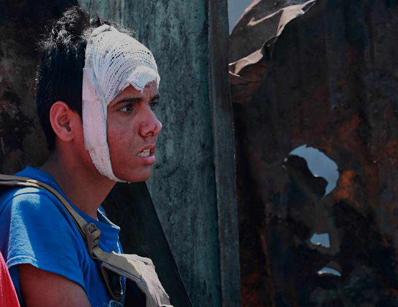 A protester returns after receiving first aid during clashes in Baghdad, Iraq. AP Photo