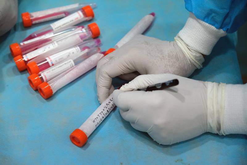 A health worker writes on a vial while conducting Covid-19 reverse transcription polymerase chain reaction tests on Delhi Municipal Corp. workers in New Delhi, India. Bloomberg