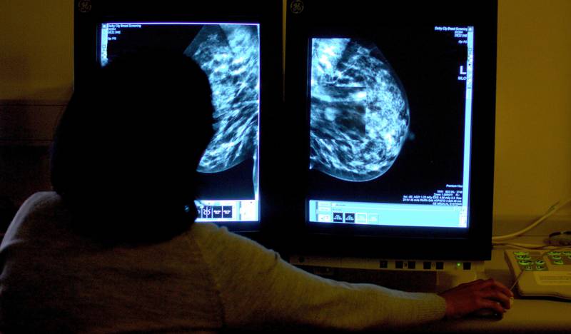 About four in 10 cancer cases are preventable, a cancer charity has said. PA