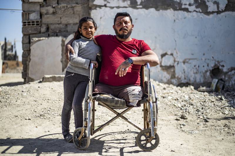 Ahmad Hajj Hmaidy, 36, lost his legs in a 2017 landmine explosion in Raqa, Syria, that also injured his daughter Nada, nine. AFP