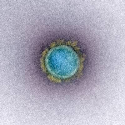 A National Institutes of Health transmission electron micrograph of the coronavirus particle.
