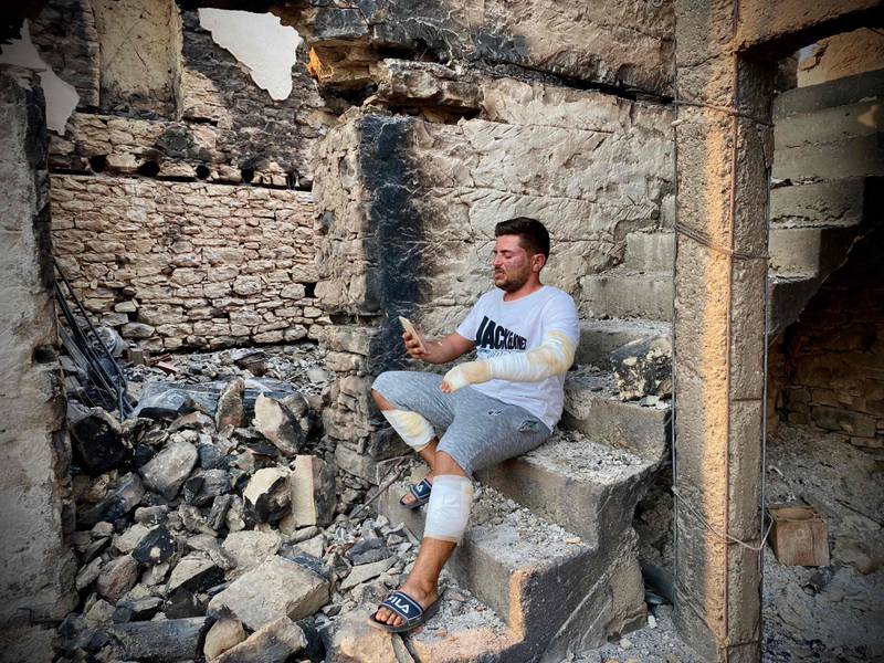 An injured man inside what remains of a house after a bushfire engulfed a resort region on Turkey's southern coast, near the town of Manavgat.