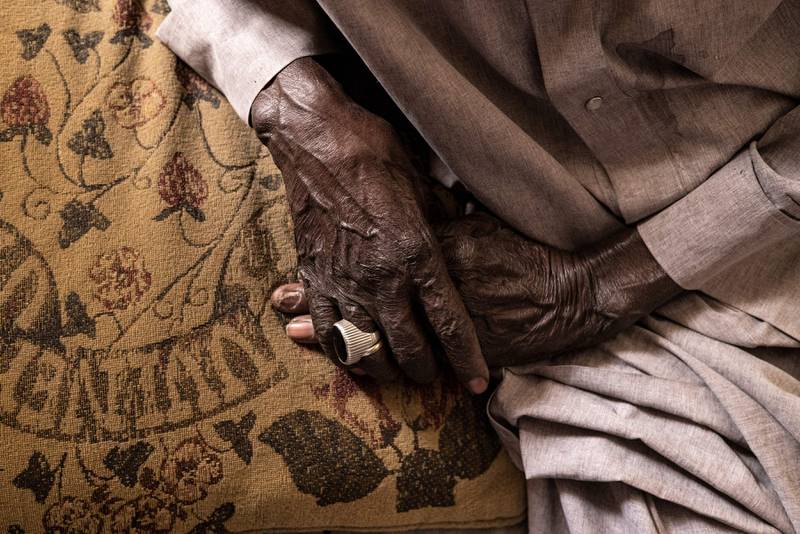 The hands of Diogo Dieye, 103 