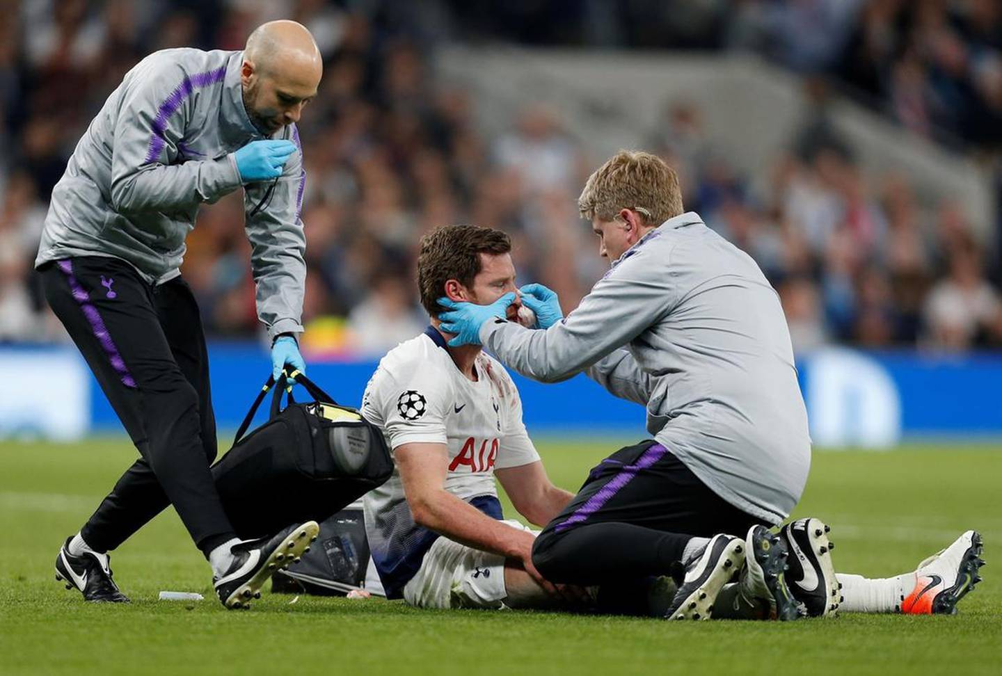 Tottenham defender Jan Vertonghen receives medical treatment. AFP