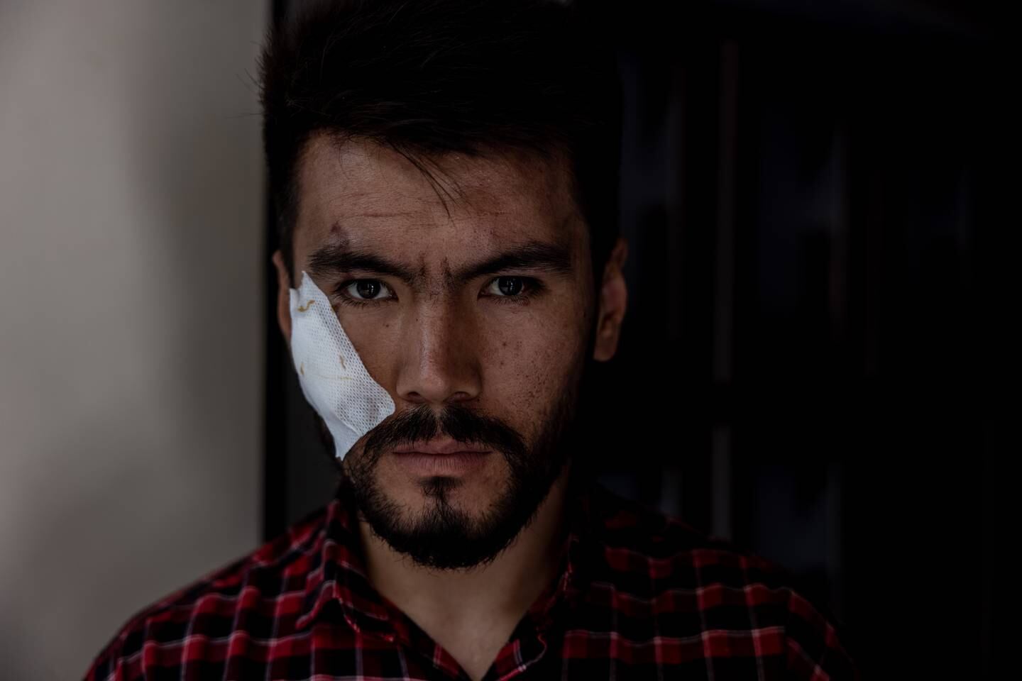 Nehmatullah Naqdi, 28, a video journalist with the EtilaatRoz newspaper, was also severely beaten by the Taliban. 