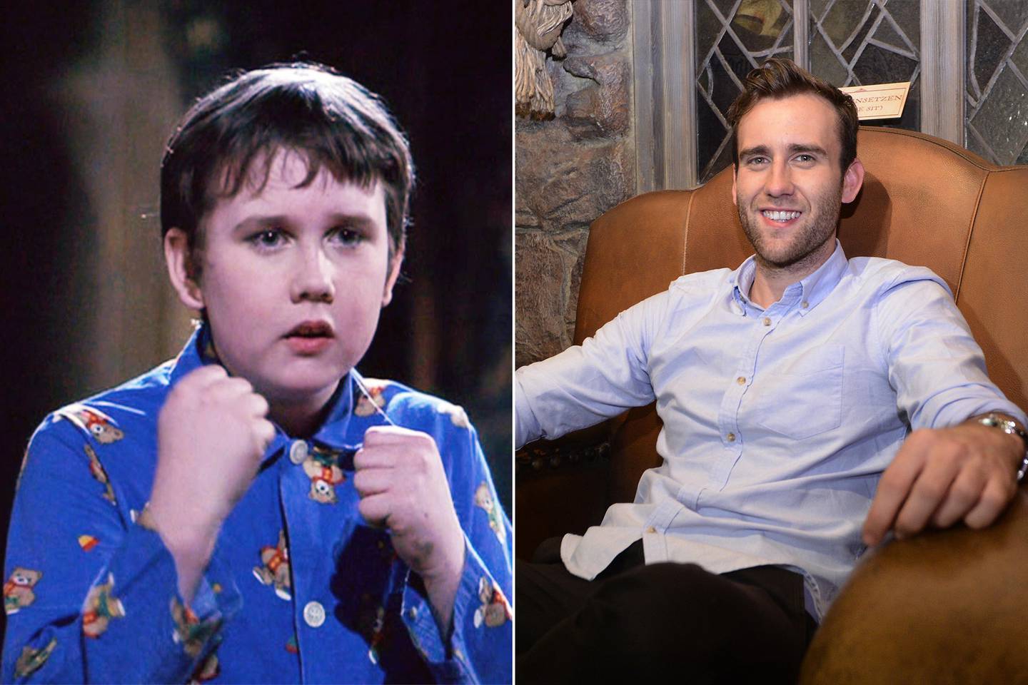 After his world-famous 'glow-up', Matthew Lewis has enjoyed huge success on the small screen in his native UK. Photo: Warner Bros / EPA