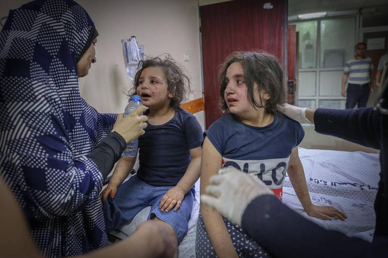 Palestinian children injured during Israeli air strikes on Gaza City are treated at Al Shifa hospital. AFP