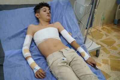 Ishaq Naseer, another young survivor, is recovering at hospital. Ismael Adnan for The National